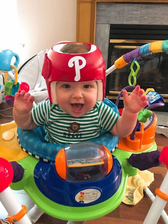 My Son Was In A Helmet For 6 Months For Torticollis And Stage 4 Plageocephaly In 2017