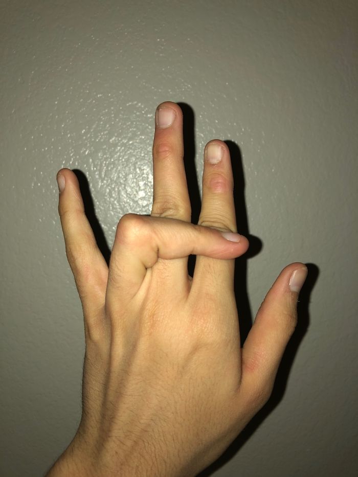 Does This Look Like It Hurts?