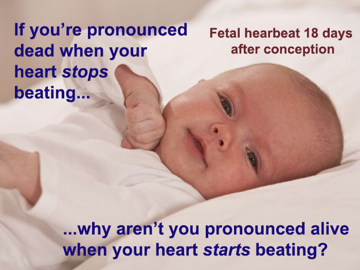 Anti-Abortion Advocate Uses Baby's Picture To Emotionally Manipulate People, Gets Destroyed With Facts Anti-Abortion Advocate Uses Baby's Picture To Emotionally Manipulate People, Gets Destroyed With Facts