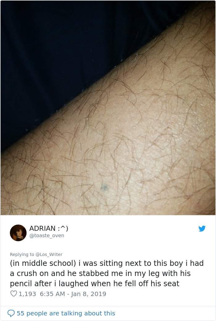 Apparently, Pencil Scars Are A Thing And There Are More People Affected Then You Would Think Apparently, Pencil Scars Are A Thing And There Are More People Affected Then You Would Think