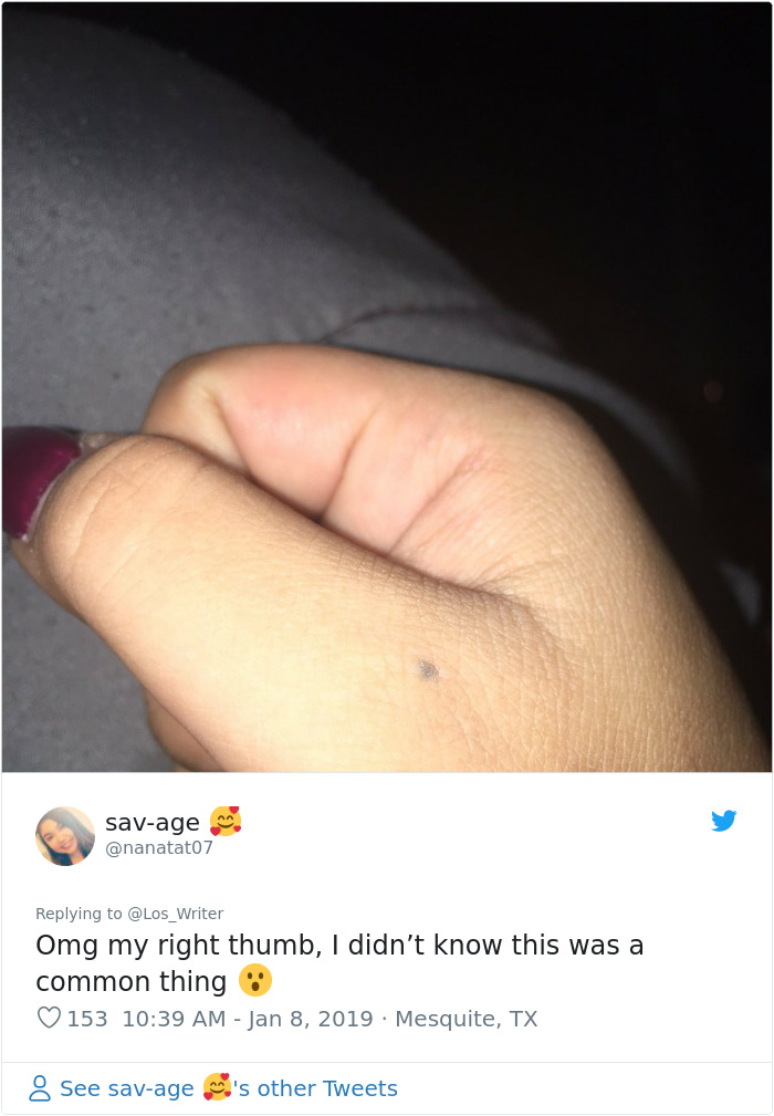 Apparently, Pencil Scars Are A Thing And There Are More People Affected Then You Would Think Apparently, Pencil Scars Are A Thing And There Are More People Affected Then You Would Think