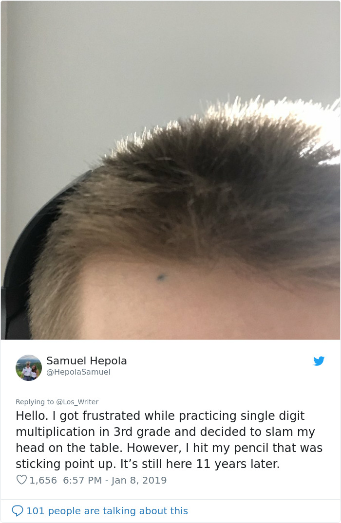 Apparently, Pencil Scars Are A Thing And There Are More People Affected Then You Would Think Apparently, Pencil Scars Are A Thing And There Are More People Affected Then You Would Think