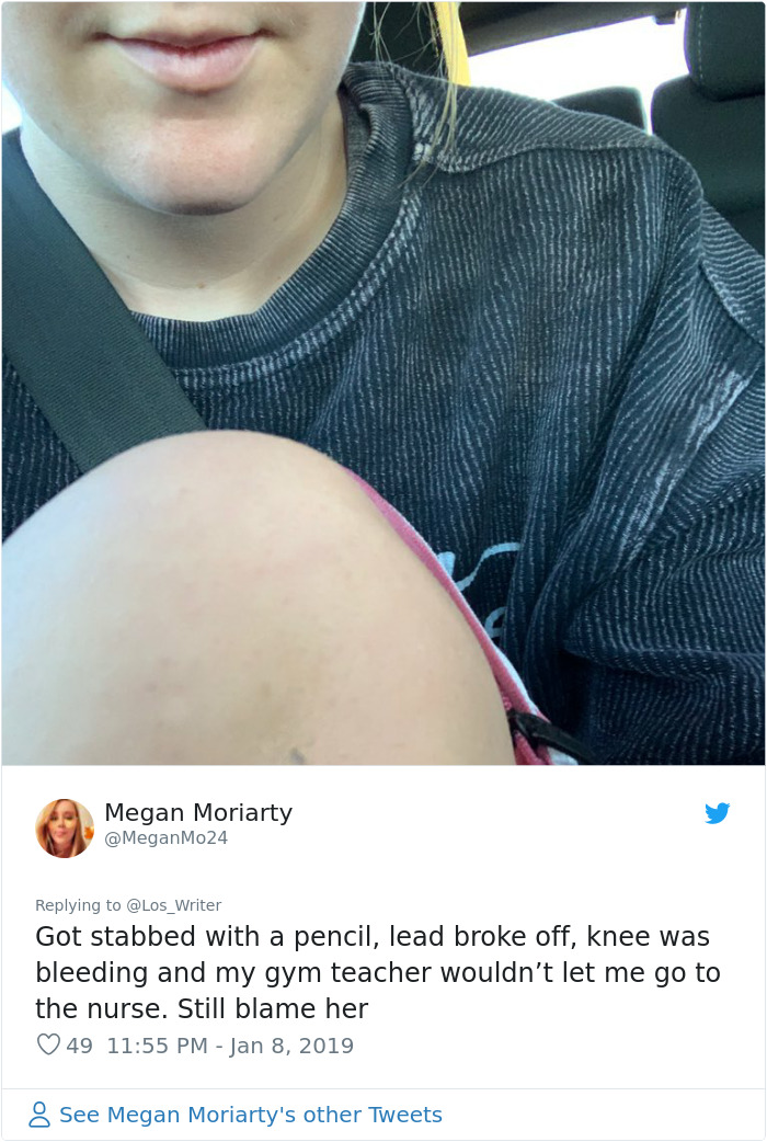 Apparently, Pencil Scars Are A Thing And There Are More People Affected Then You Would Think Apparently, Pencil Scars Are A Thing And There Are More People Affected Then You Would Think