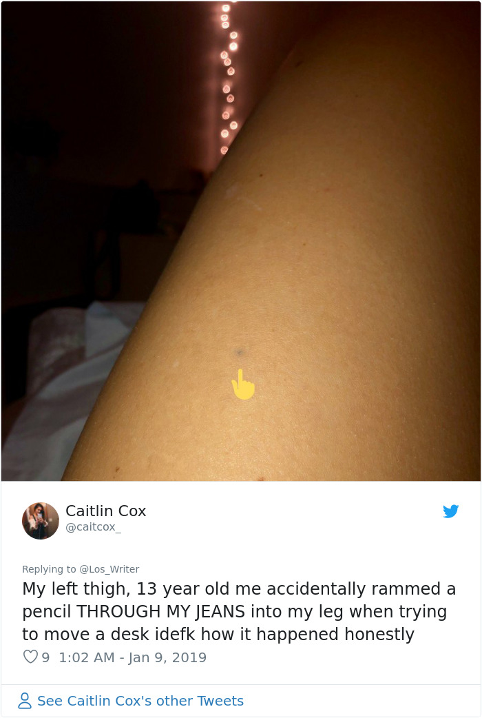 Apparently, Pencil Scars Are A Thing And There Are More People Affected Then You Would Think Apparently, Pencil Scars Are A Thing And There Are More People Affected Then You Would Think