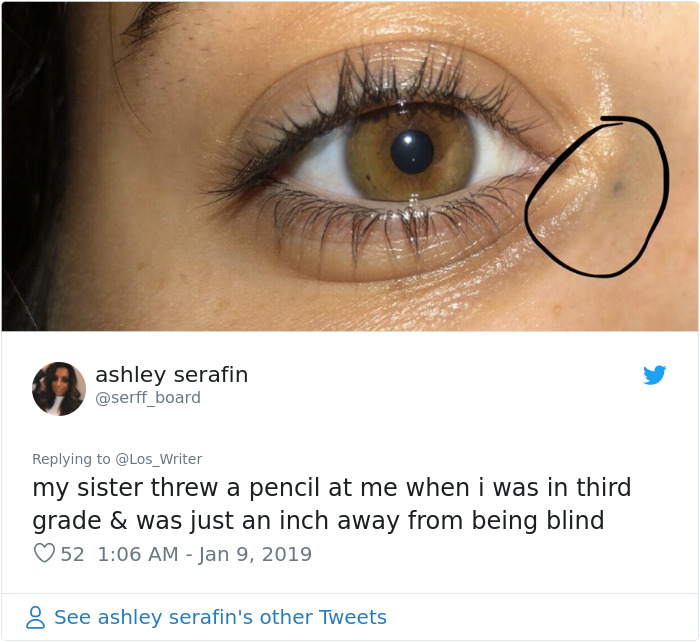 Apparently, Pencil Scars Are A Thing And There Are More People Affected Then You Would Think Apparently, Pencil Scars Are A Thing And There Are More People Affected Then You Would Think