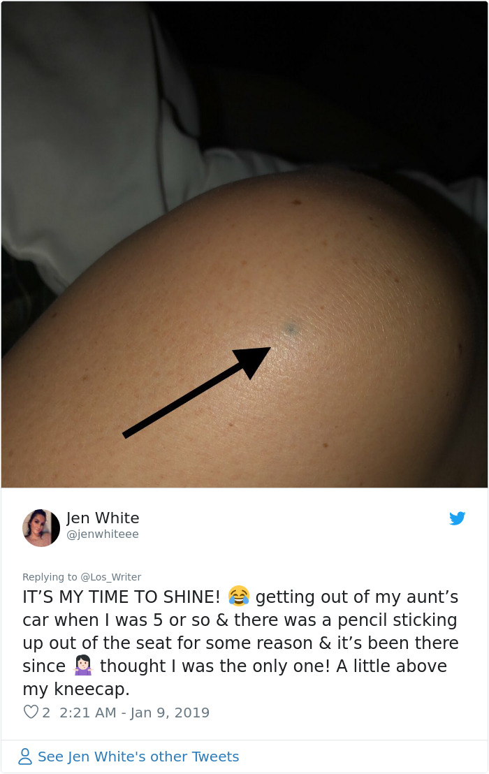 Apparently, Pencil Scars Are A Thing And There Are More People Affected Then You Would Think Apparently, Pencil Scars Are A Thing And There Are More People Affected Then You Would Think