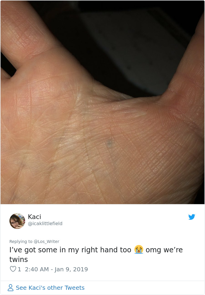 Apparently, Pencil Scars Are A Thing And There Are More People Affected Then You Would Think Apparently, Pencil Scars Are A Thing And There Are More People Affected Then You Would Think