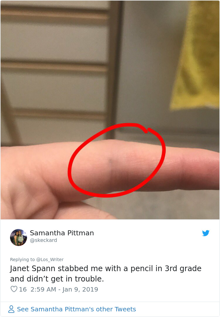 Apparently, Pencil Scars Are A Thing And There Are More People Affected Then You Would Think Apparently, Pencil Scars Are A Thing And There Are More People Affected Then You Would Think
