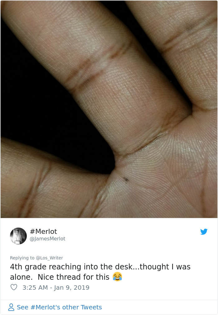 Apparently, Pencil Scars Are A Thing And There Are More People Affected Then You Would Think Apparently, Pencil Scars Are A Thing And There Are More People Affected Then You Would Think