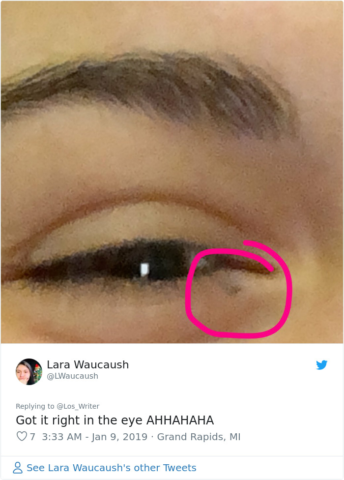 Apparently, Pencil Scars Are A Thing And There Are More People Affected Then You Would Think Apparently, Pencil Scars Are A Thing And There Are More People Affected Then You Would Think