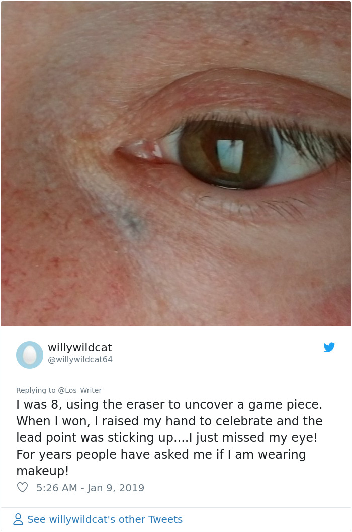 Apparently, Pencil Scars Are A Thing And There Are More People Affected Then You Would Think Apparently, Pencil Scars Are A Thing And There Are More People Affected Then You Would Think