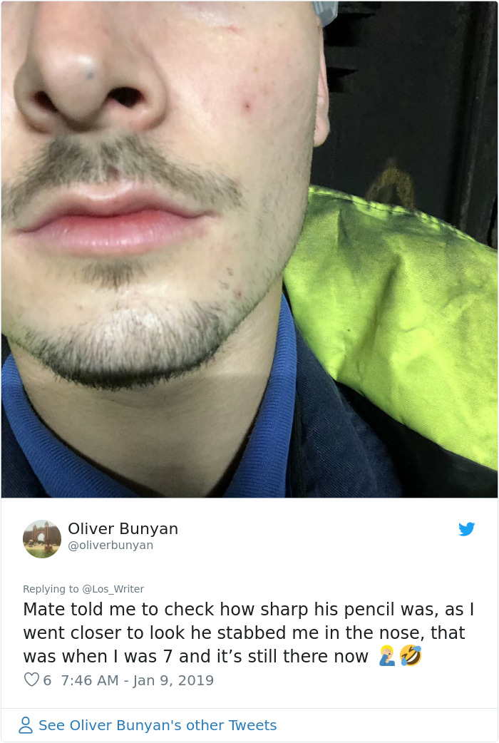 Apparently, Pencil Scars Are A Thing And There Are More People Affected Then You Would Think Apparently, Pencil Scars Are A Thing And There Are More People Affected Then You Would Think