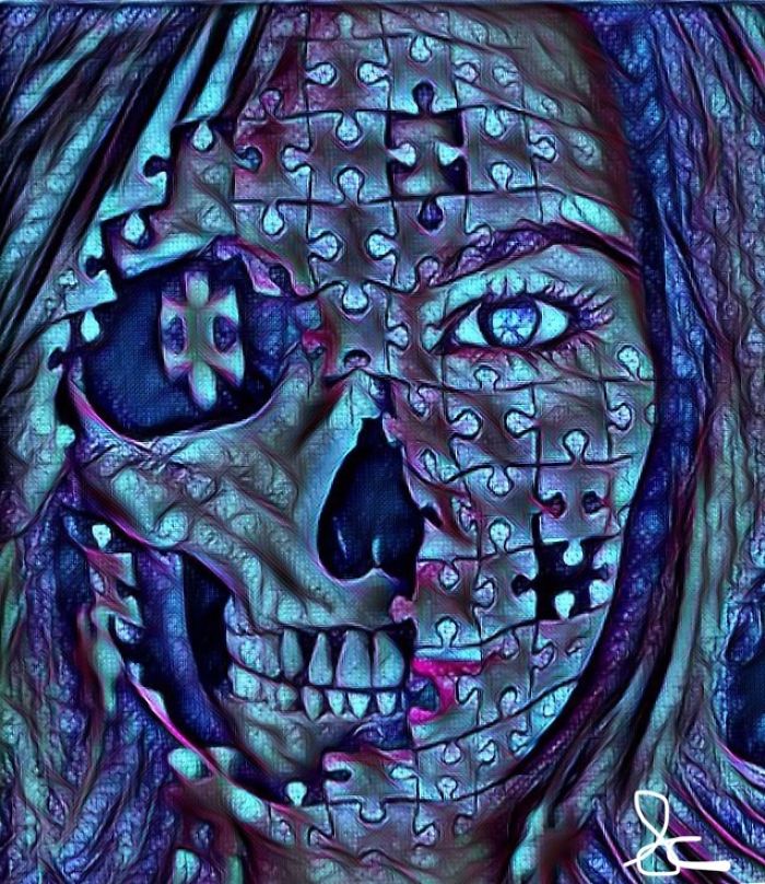 Living With A Concussion Living With A Concussion