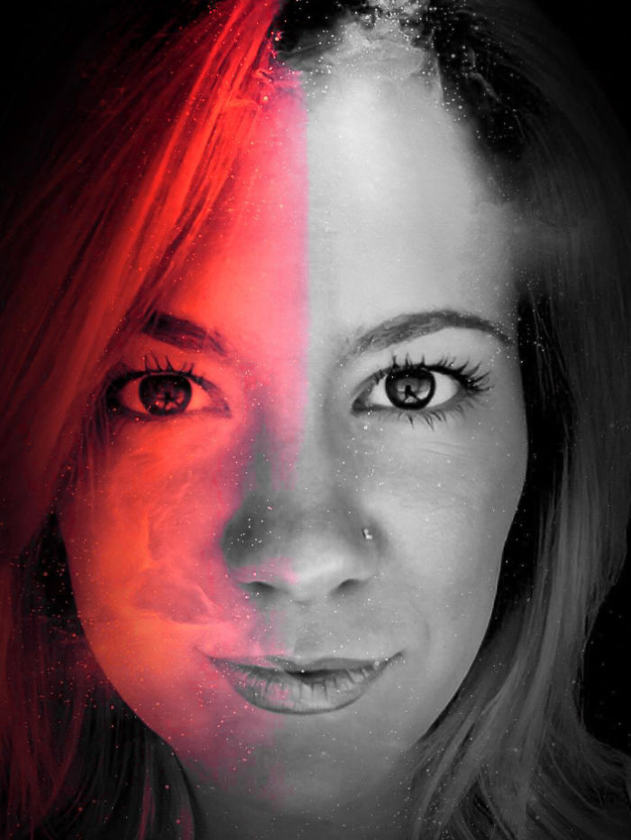 Living With A Concussion Living With A Concussion