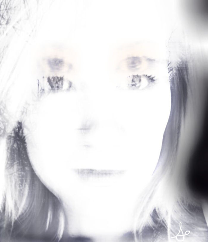 Living With A Concussion