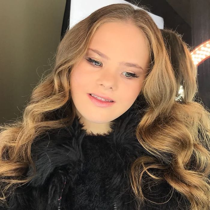 Meet This Teen With Down's Syndrome Who Has Already Signed For 5 Modeling Agencies And Has 50k Followers On Instagram Meet This Teen With Down's Syndrome Who Has Already Signed For 5 Modeling Agencies And Has 50k Followers On Instagram