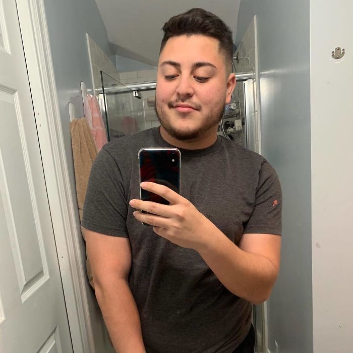 Apparently, Pencil Scars Are A Thing And There Are More People Affected Then You Would Think Apparently, Pencil Scars Are A Thing And There Are More People Affected Then You Would Think