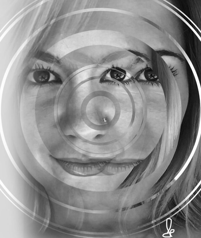 Living With A Concussion