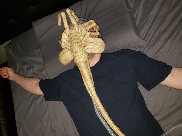 Doctors Tell This Man That He Needs To Wear A Mask To Help Him Breathe So He Turns It Into Alien Facehugger Doctors Tell This Man That He Needs To Wear A Mask To Help Him Breathe So He Turns It Into Alien Facehugger
