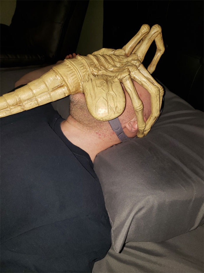 Doctors Tell This Man That He Needs To Wear A Mask To Help Him Breathe So He Turns It Into Alien Facehugger Doctors Tell This Man That He Needs To Wear A Mask To Help Him Breathe So He Turns It Into Alien Facehugger