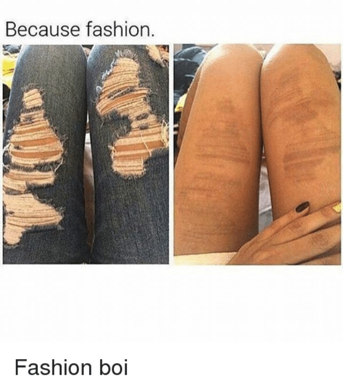 Ripped jeans causing hilarious fashion disaster imprint on legs.