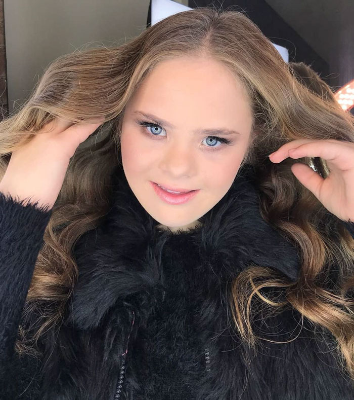 Meet This Teen With Down's Syndrome Who Has Already Signed For 5 Modeling Agencies And Has 50k Followers On Instagram Meet This Teen With Down's Syndrome Who Has Already Signed For 5 Modeling Agencies And Has 50k Followers On Instagram