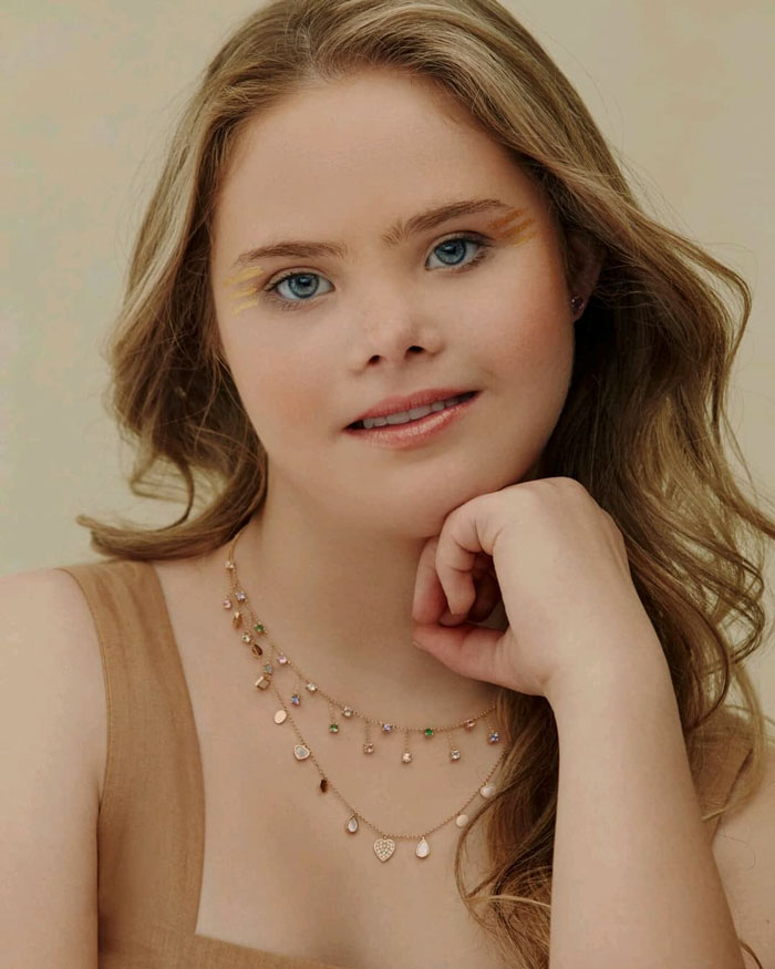 Meet This Teen With Down's Syndrome Who Has Already Signed For 5 Modeling Agencies And Has 50k Followers On Instagram Meet This Teen With Down's Syndrome Who Has Already Signed For 5 Modeling Agencies And Has 50k Followers On Instagram
