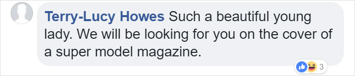 Meet This Teen With Down's Syndrome Who Has Already Signed For 5 Modeling Agencies And Has 50k Followers On Instagram Meet This Teen With Down's Syndrome Who Has Already Signed For 5 Modeling Agencies And Has 50k Followers On Instagram
