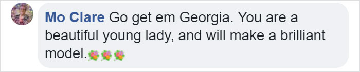 Meet This Teen With Down's Syndrome Who Has Already Signed For 5 Modeling Agencies And Has 50k Followers On Instagram