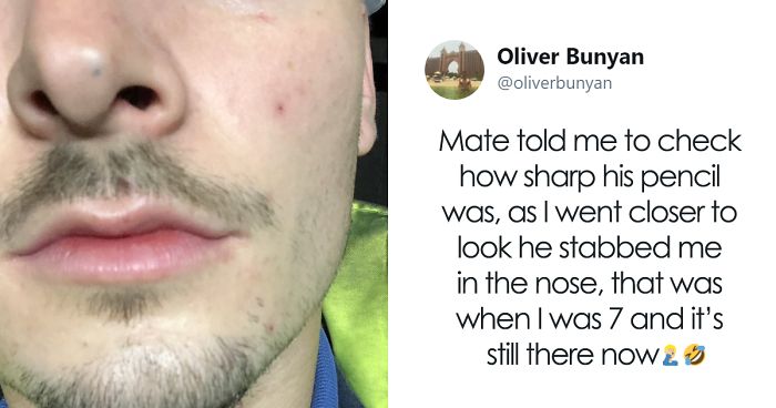 Apparently, Pencil Scars Are A Thing And There Are More People Affected Then You Would Think