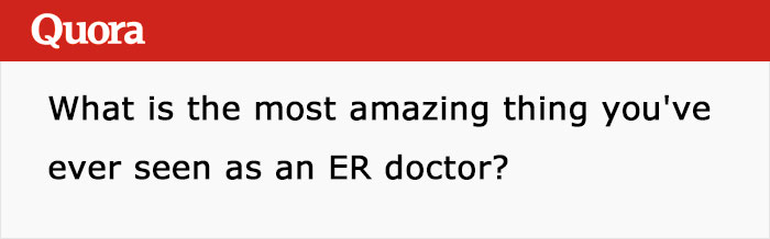 Someone Asks ER Doctors What Are The Most Amazing Things They Have Seen, And This Answer Wins Someone Asks ER Doctors What Are The Most Amazing Things They Have Seen, And This Answer Wins