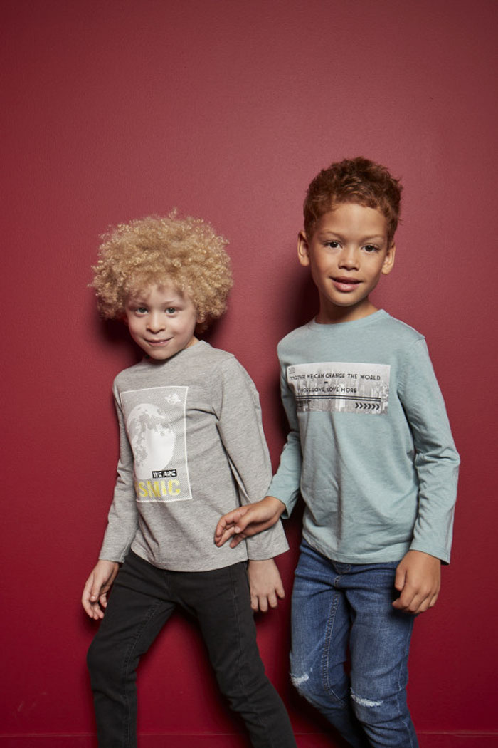 5-Year-Old Albino Boy Becomes Model For Primark After Mum Shares His Pic On Facebook 5-Year-Old Albino Boy Becomes Model For Primark After Mum Shares His Pic On Facebook