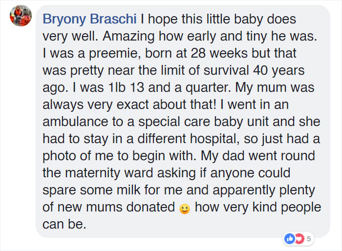 After Spending Months In The Hospital, The World's Smallest Surviving Premature Baby Has Been Finally Sent Home After Spending Months In The Hospital, The World's Smallest Surviving Premature Baby Has Been Finally Sent Home