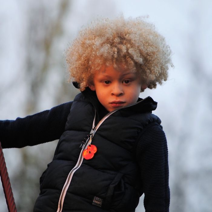 5-Year-Old Albino Boy Becomes Model For Primark After Mum Shares His Pic On Facebook 5-Year-Old Albino Boy Becomes Model For Primark After Mum Shares His Pic On Facebook