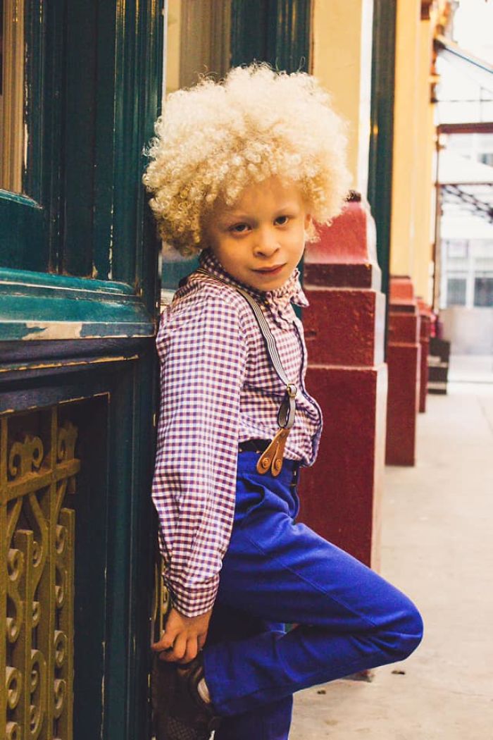 5-Year-Old Albino Boy Becomes Model For Primark After Mum Shares His Pic On Facebook