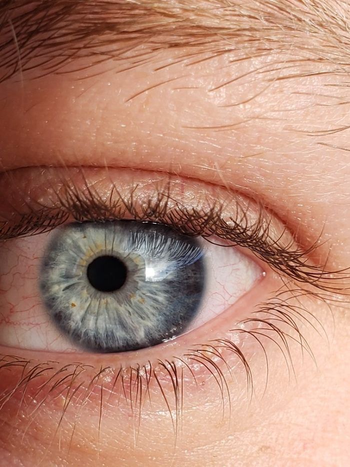 My Buddy's Off-Centered Pupil