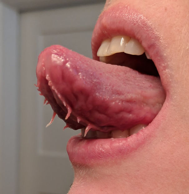 I Have Tentacles Under My Tongue- Apparently Not Everyone Does?