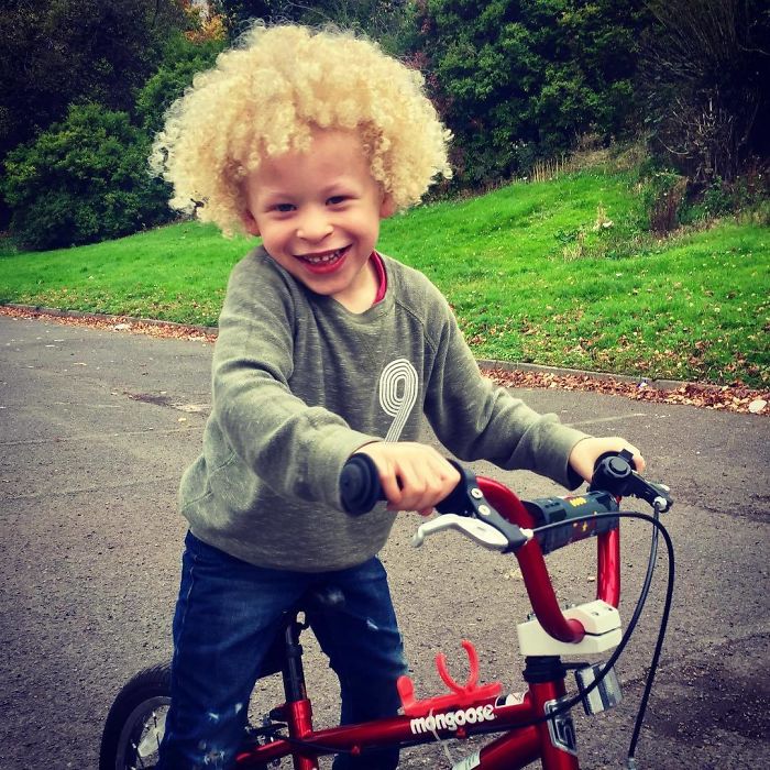 5-Year-Old Albino Boy Becomes Model For Primark After Mum Shares His Pic On Facebook 5-Year-Old Albino Boy Becomes Model For Primark After Mum Shares His Pic On Facebook