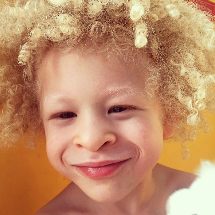 5-Year-Old Albino Boy Becomes Model For Primark After Mum Shares His Pic On Facebook 5-Year-Old Albino Boy Becomes Model For Primark After Mum Shares His Pic On Facebook