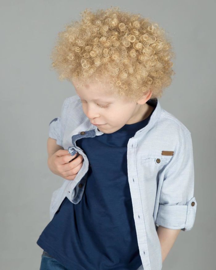 5-Year-Old Albino Boy Becomes Model For Primark After Mum Shares His Pic On Facebook 5-Year-Old Albino Boy Becomes Model For Primark After Mum Shares His Pic On Facebook