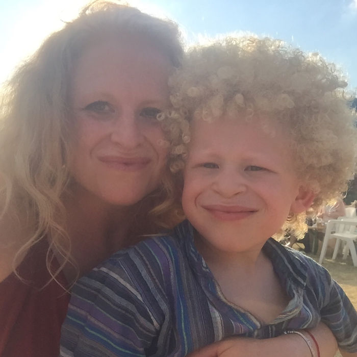 5-Year-Old Albino Boy Becomes Model For Primark After Mum Shares His Pic On Facebook 5-Year-Old Albino Boy Becomes Model For Primark After Mum Shares His Pic On Facebook