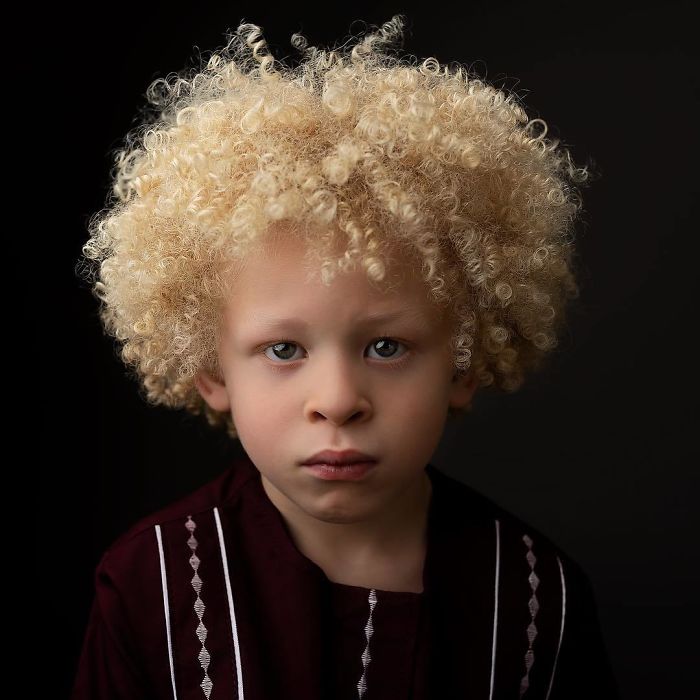 5-Year-Old Albino Boy Becomes Model For Primark After Mum Shares His Pic On Facebook