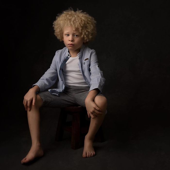 5-Year-Old Albino Boy Becomes Model For Primark After Mum Shares His Pic On Facebook