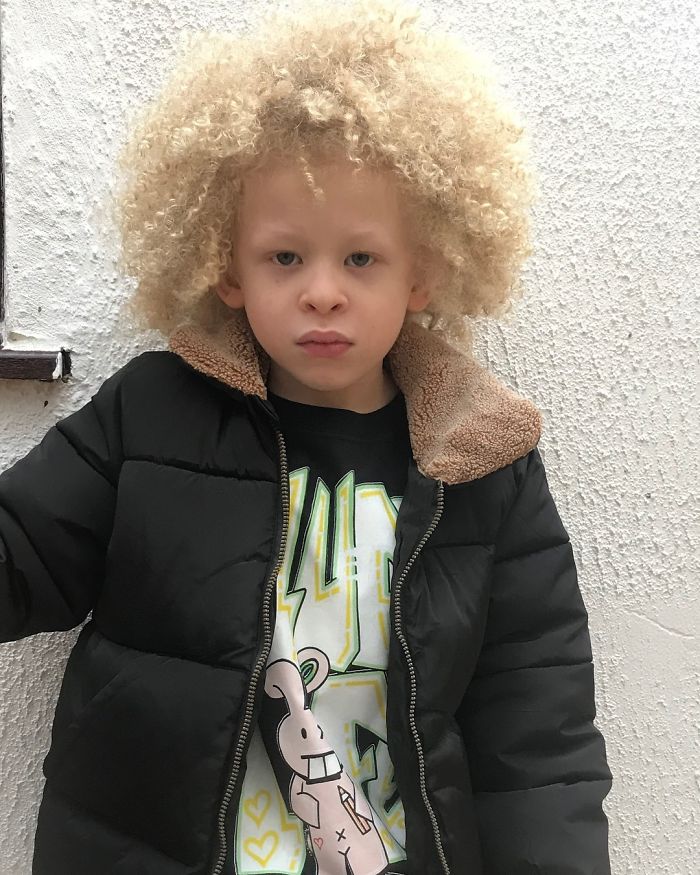 5-Year-Old Albino Boy Becomes Model For Primark After Mum Shares His Pic On Facebook 5-Year-Old Albino Boy Becomes Model For Primark After Mum Shares His Pic On Facebook