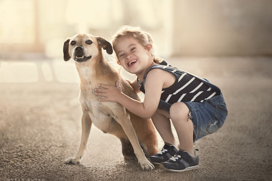 Noam With Down Syndrome And Ben-Ben Without Back Legs
