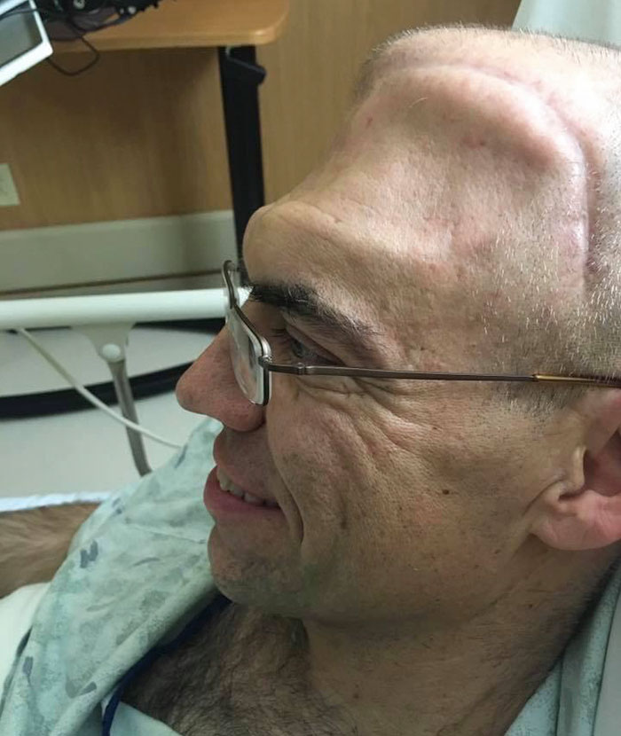 Guy Who Was Supposed To Live For 6 Years After Brain Cancer Diagnosis, Lives For 20+ Years, Beats It 4 Times Guy Who Was Supposed To Live For 6 Years After Brain Cancer Diagnosis, Lives For 20+ Years, Beats It 4 Times
