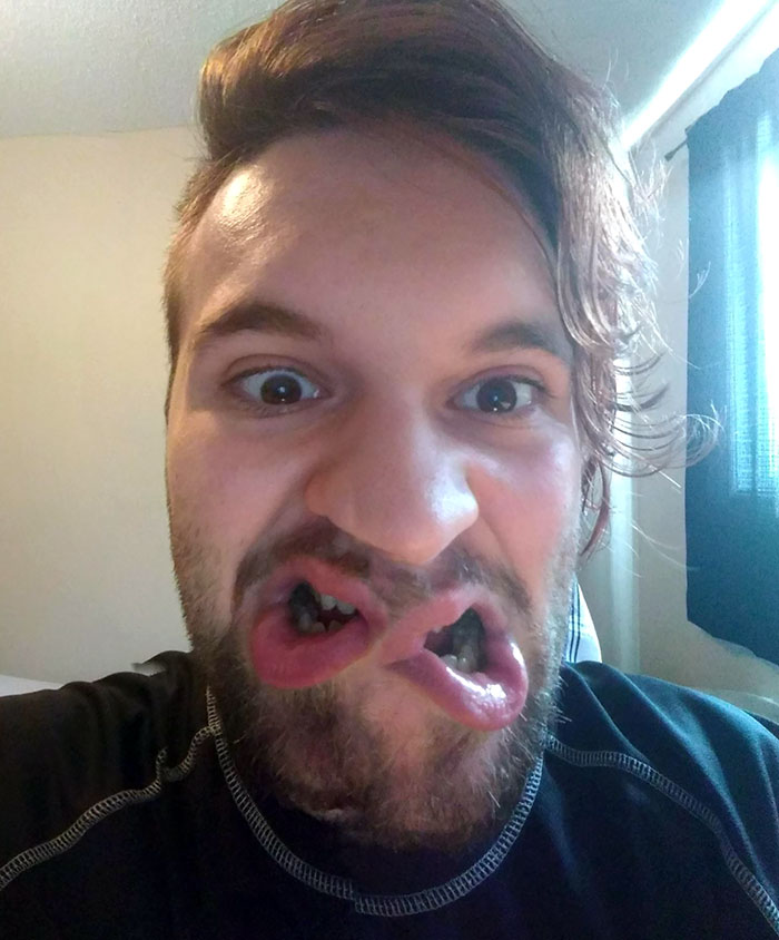 Pano Dual Mouth. For All Those Pizza Eating Needs