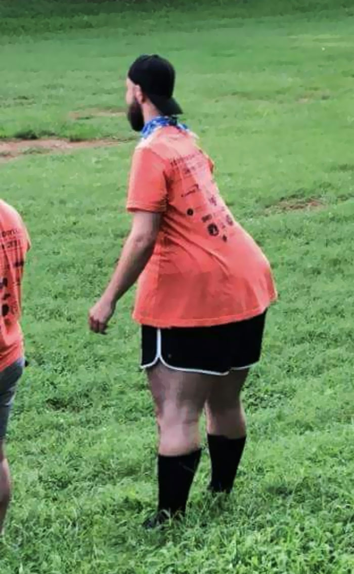 Do Not Bend Over During A Panoramic