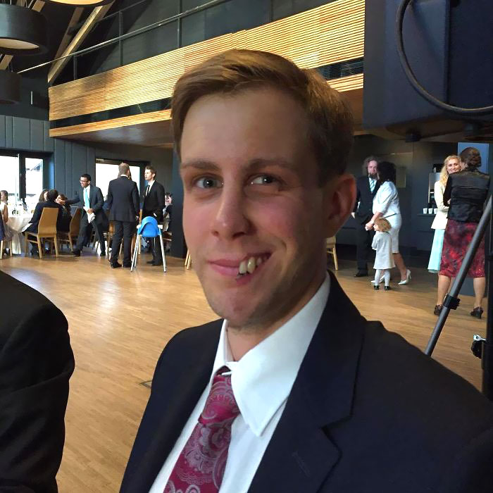 This Is My Friend Filip. Last Week He Had An Accident