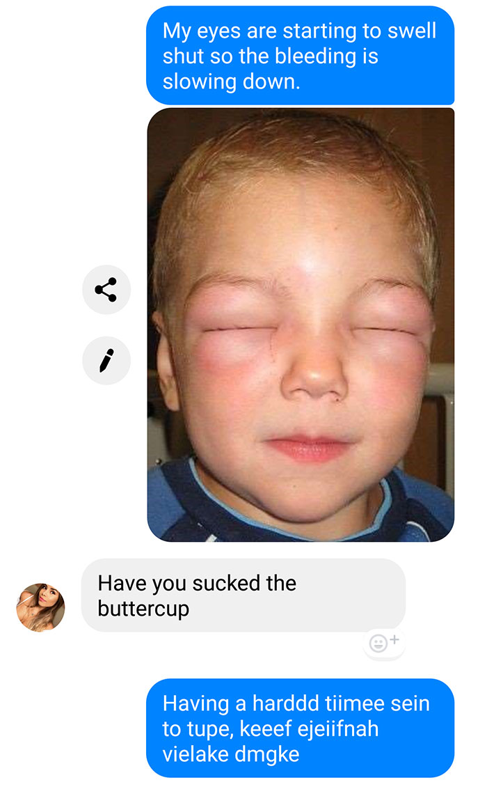 Guy Pranks Online Scammer By Sending Them Fake Pics Of Awful Things That Are Happening To Him Guy Pranks Online Scammer By Sending Them Fake Pics Of Awful Things That Are Happening To Him